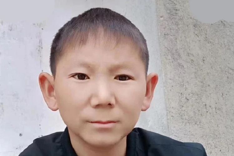 Zhu Shengkai. Pria asal Wuhan, China, yang menjadi pemberitaan setempat setelah mengalami kondisi di mana dia tak bisa tumbuh dan tampak seperti anak kecil.