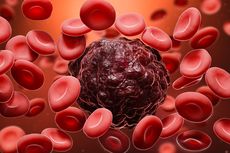 6 Cara Mencegah Kanker Darah, Kelola Faktor Risiko yang Bisa Dikontrol