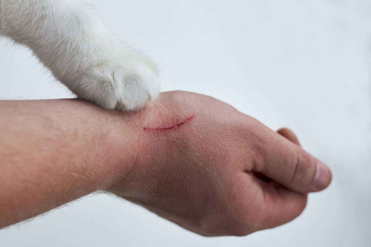 ilustrasi Cat scratch disease