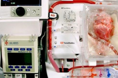 Inovasi Menjaga Organ Jantung Tetap Hidup di Luar Tubuh
