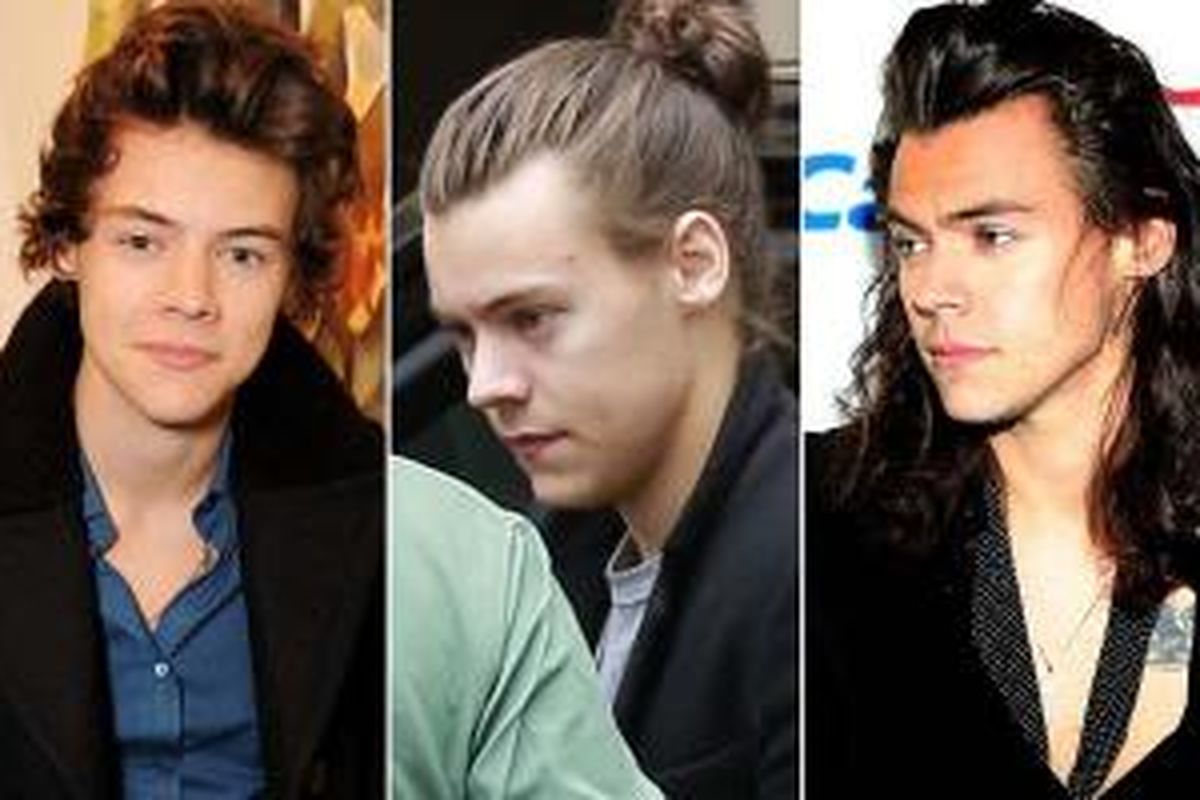 Perubahan garis rambut Harry Styles yang mengalami tarikan mundur dari waktu ke waktu. 