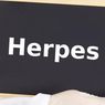 Penyebab Herpes Kulit dan Cara Mengobatinya