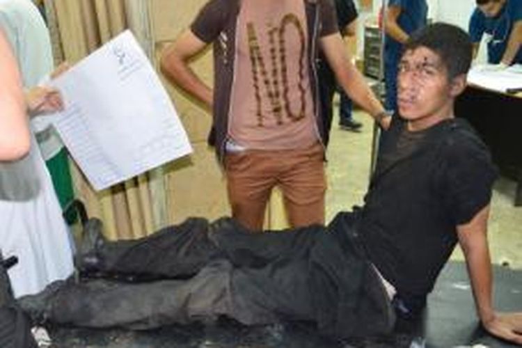 Seorang korban luka terduduk setelah sebuah serangan granat di kantor polisi Dahgaliya, Mansura, Mesir, Rabu (24/7/2013). Delapan polisi luka akibat serangan ini.
