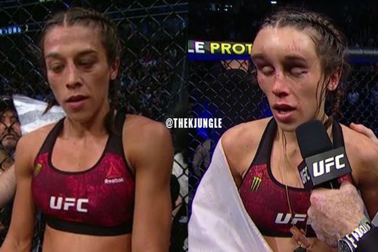 Petarung UFC, Joanna Jedrzejczyk, sebelum (kiri) dan sesudah pertarungan melawan Zhang Weili pada UFC 248, Minggu (8/3/2020) pagi WIB.