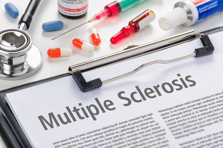 Ilustrasi Multiple Sclerosis (MS). Terapi MS dapat menurunkan imunitas tubuh penderitanya.