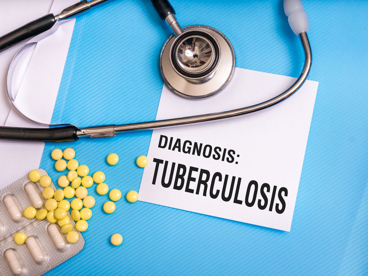 Kasus TBC di Buleleng Tertinggi Kedua di Bali, Bupati: Wajar Penduduk Banyak