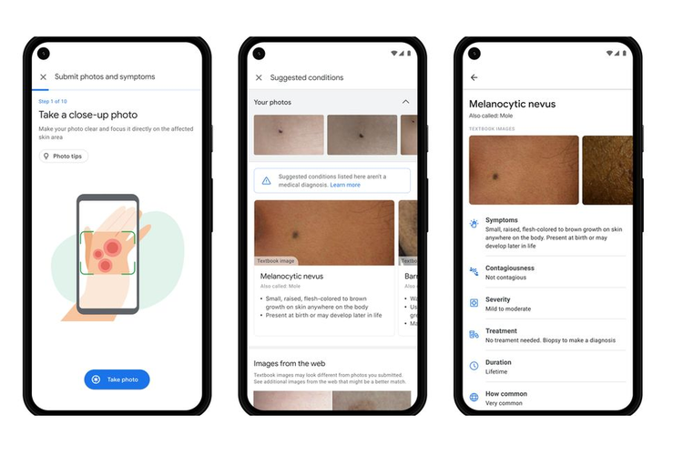 Alat AI Google yang digunakan untuk membantu mengecek kondisi kulit.