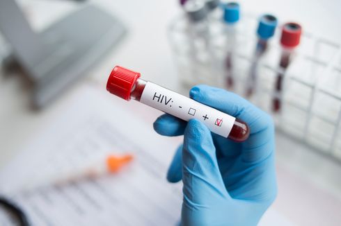 Kasus HIV di Palembang Tertinggi Se-Sumsel, Diikuti Banyuasin dan OKI