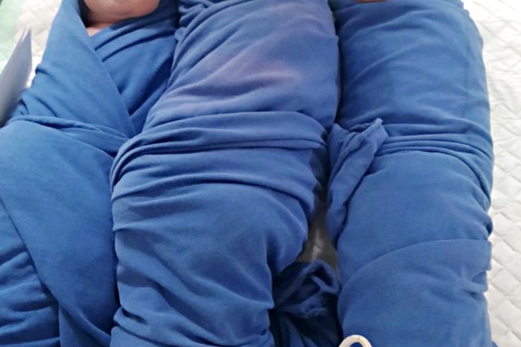 Ibu di Bangkalan Lahirkan 3 Bayi Kembar di Usia 8 Bulan Kandungan