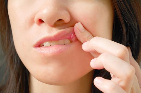 8 Penyebab Mulut Kering dan Cara Mengatasinya