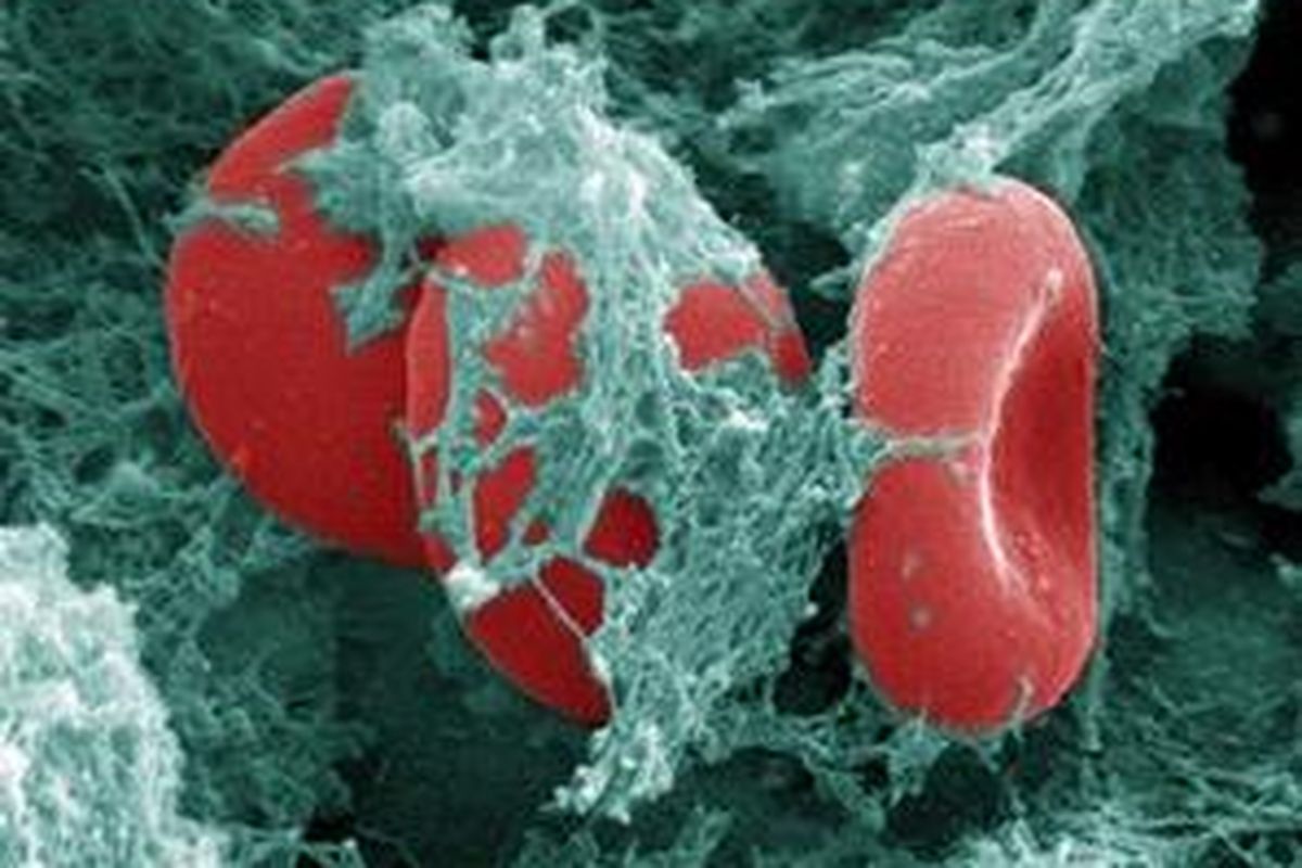 Sel darah merah, dilihat dari elektron mikrograf.