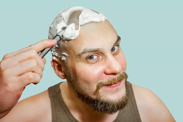 Cara merawat kepala botak