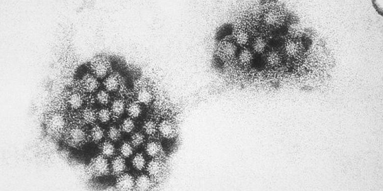 ウイルスは生き物ではないとする2つの理由