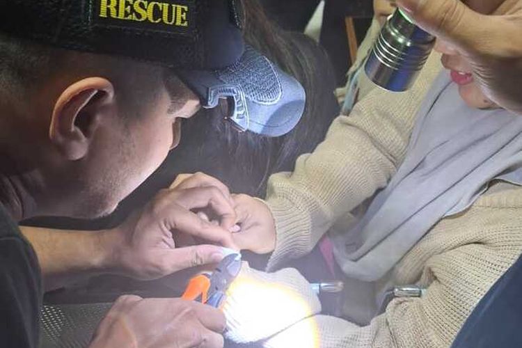 Petugas Diskar PB Kota bandung tengah berupaya membuka tutup kemasan lem yang menyangkut di jari balita di Bandung, Rabu (25/6/2025)