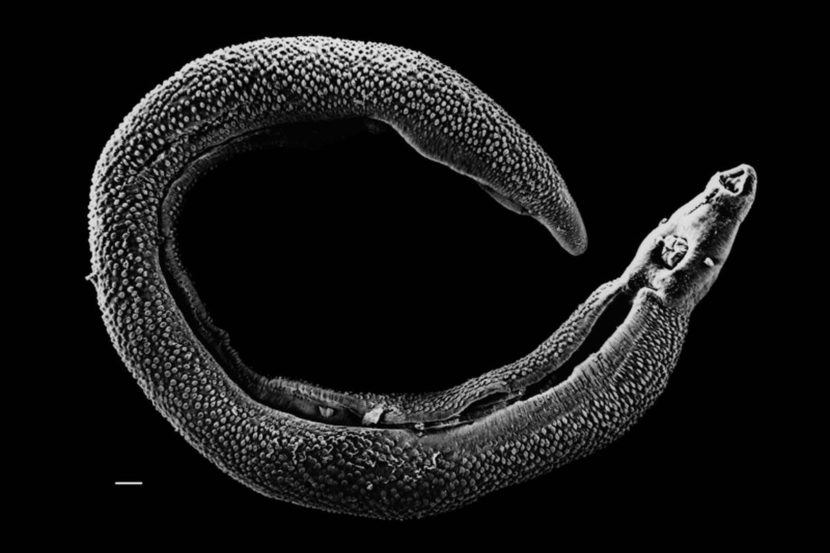 Schistosoma penyakit mematikan. Penampakan cacing pipih bila dilihat dari mikroskop. 