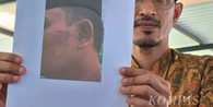 Korban Dugaan Penganiayaan 13 Santri di Ponpes Ora Aji Milik Miftah Masih Alami Trauma