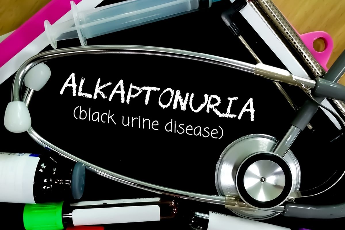 Ilustrasi Alkaptonuria