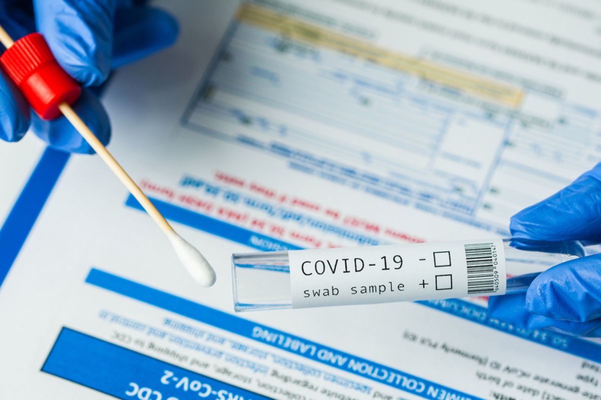 Ilustrasi tes Covid-19 menggunakan tes swab antigen atau tes PCR yang bisa dilakukan saat curiga terpapar Covid-19.