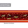 Bakteremia