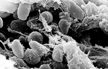 Yersinia pestis, bakteria penyebab wabah