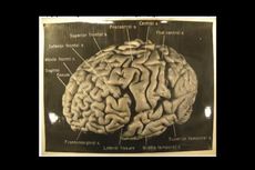 Inilah Rupa Otak Einstein
