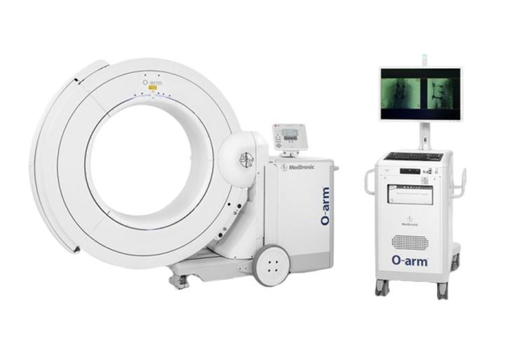 Mesin O-arm yang dapat membantu operasi skoliosis. 

