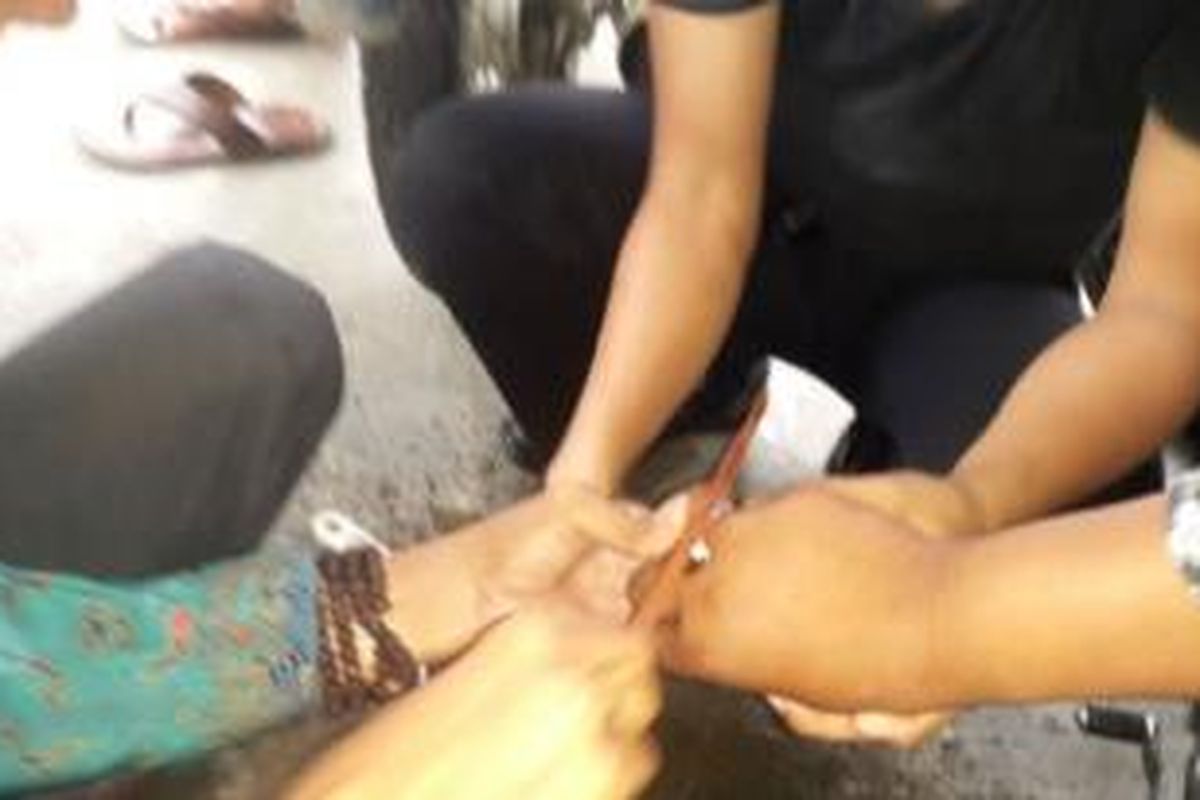 Rekan Debby Triansyah berusaha memotong cincin di tangan Debby Triansyah