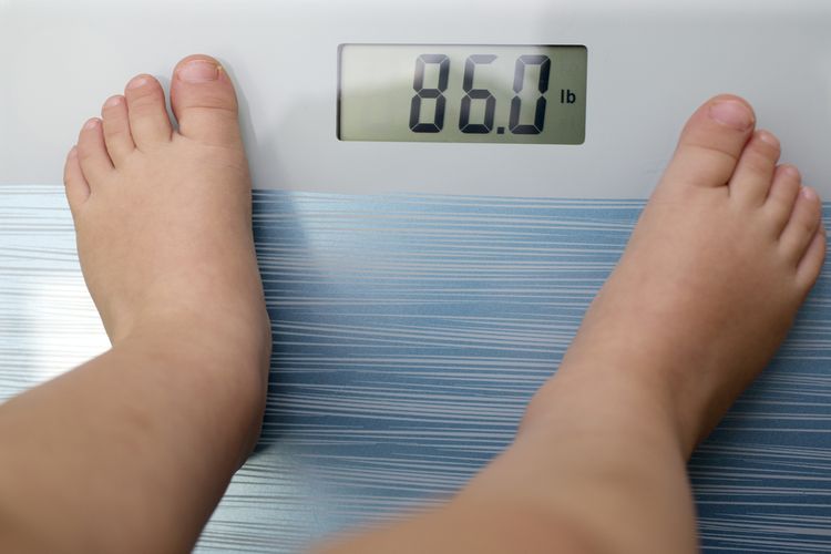 Ilustrasi anak obesitas akibat gizi berlebih.