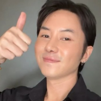 Rafael Tan setelah operasi plastik