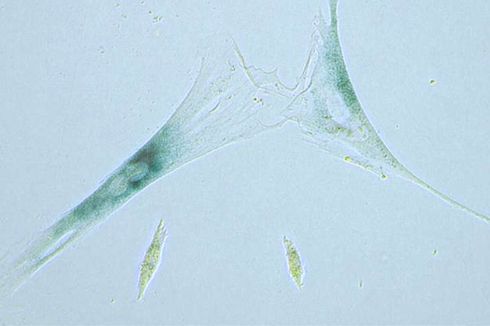 Atasi Penuaan, Ilmuwan Buat Obat Lawan Sel Zombie