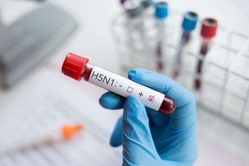 Kasus Penularan Flu Burung dari Sapi ke Manusia Terkonfirmasi di AS