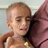 Nasib Bayi-bayi Afghanistan, Hidup Kelaparan dalam Krisis Tanpa Perawatan Layak