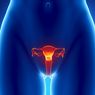 7 Penyakit yang Mengintai Sistem Reproduksi Wanita