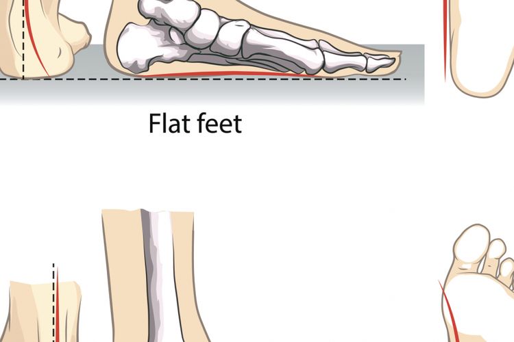 Ilustrasi telapak kaki