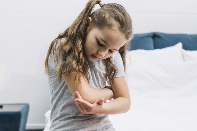 Ilustrasi anak luka lebam/memar.