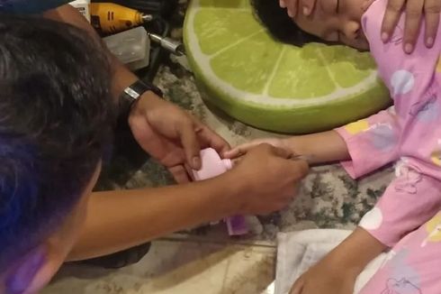 Jari Tangannya Terjepit di Lubang Tutup Botol, Anak Ini Pilih ke Damkar daripada Ditolong Dokter