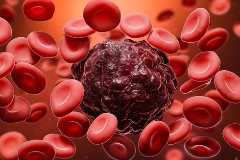 Kenali 3 Jenis Kanker Darah yang Rentan Menyerang Lansia