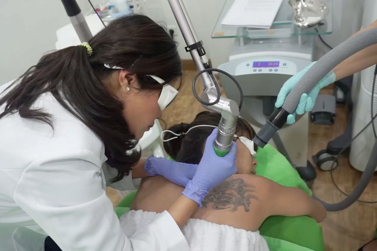 Menghapus tato dengan sinar laser di ZAP Beauty Clinic.