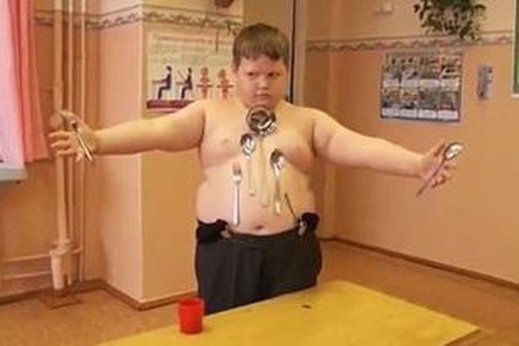 Nikolai Kryaglyachenko (12) menjadi manusia magnet setelah tersengat listrik tegangan tinggi.