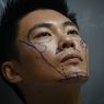Ingin Peluang Hidup Lebih Baik, Pria Muda China Memilih Permak Wajah