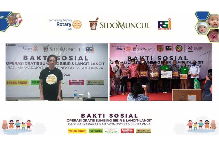 Acara operasi bibir sumbing gratis oleh Sido Muncul yang dilaksanakan secara virtual di Jakarta dan Wonosobo, Sabtu (16/7/2022).