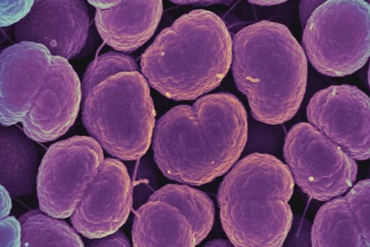 Bakteri Neisseria gonorrhoeae, penyebab infeksi menular seksual Gonore.