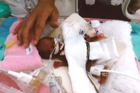 Lahir dengan Berat 258 Gram, Bayi Terkecil di Jepang Akhirnya Diizinkan Pulang