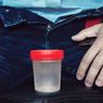 7 Obat-obatan yang Dapat Menurunkan Kualitas Sperma