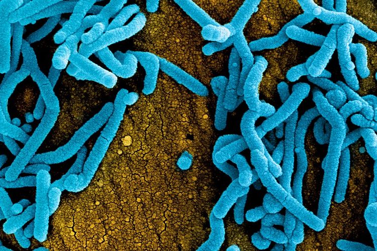 Virus Marburg, penyakit virus Marburg (MDV). Penyakit ini ditemukan muncul lagi di Afrika. Penyakit virus Marburg sangat menular dan memiliki fatalitas yang tinggi pada manusia. Virus ini berkerabat dengan virus Ebola.