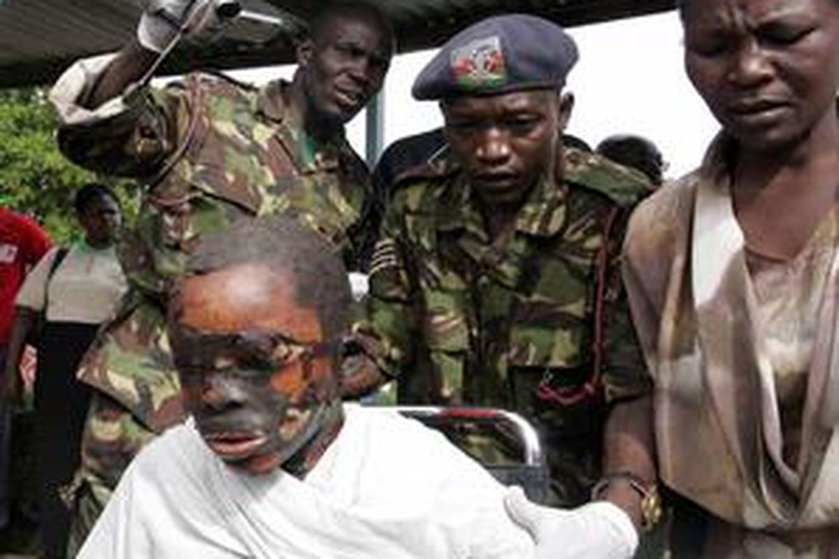 Seorang anak korban kebakaran tumpahan minyak di Kenya dilarikan ke rumah sakit, Minggu (2/1). 