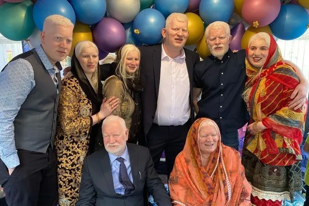Naseem Akhtar, Ghulam Ali, Haider Ali, Muqadas Bibi, Musarat Begum, Mohammed Rafi, beserta kedua orang tuanya memecahkan rekor dunia Guinness World Record karena memiliki anggota keluarga dengan albinisme terbanyak. Keluarga tersebut tinggal di Coventry, Inggris.