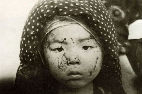 Kisah Perang: Derita Tiada Tara Hibakusha, Penyintas Bom Atom Hiroshima-Nagasaki
