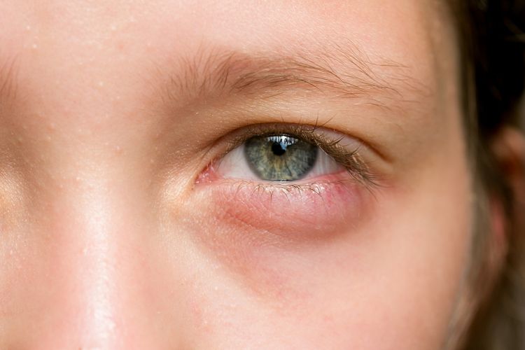 Ilustrasi mata. Berapa usia Anda saat ini? Di usia awal hingga pertengahan 40-an tahun biasanya tanda-tanda penuaan pada mata akan dimulai, seperti sulit membawa jarak dekat serta kelopak mata merah dan bengkak.