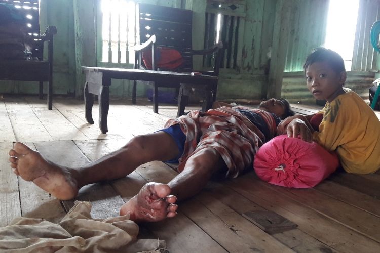 Juma Daeng Joa (39), warga Kabupaten Takalar, Sulawesi Selatan hanya bisa terbaring dan dirawat oleh putranya lantaran luka borok yan mengakibatkan kelumpuhan, Kamis, (9/3/2017). 